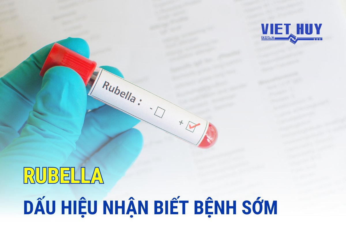 Rubella: Dấu hiệu sớm và cách phòng ngừa